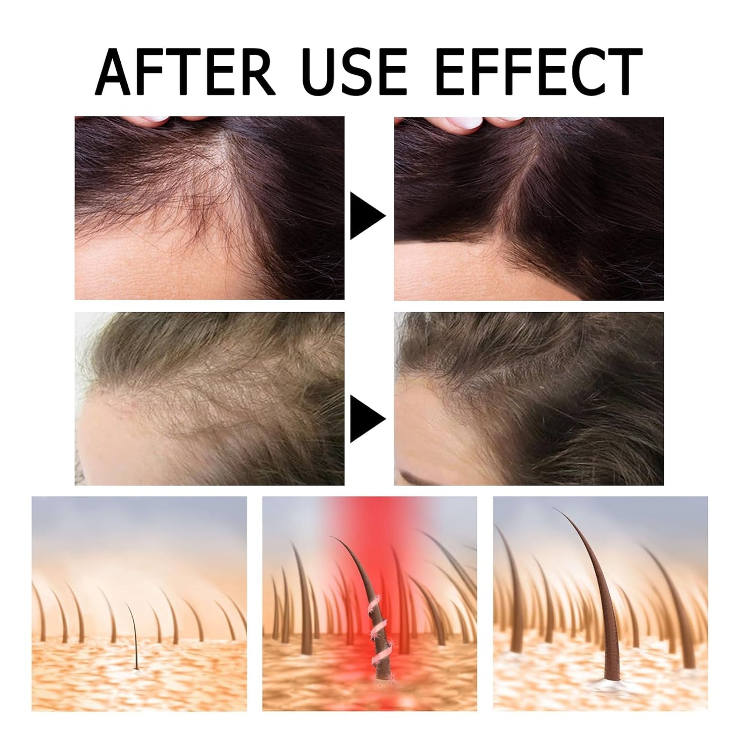 Skiennix Hair Ampoule Treatment Serum - Strengthening Nourishing Concentrate for Thinning Hair | 7 Count