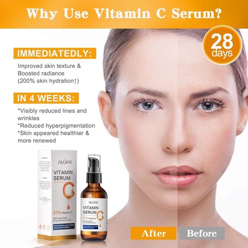 Regine Switzerland Vitamin C Serum - 31% Facial Moisturizer for Anti-Aging & Brightening | 2oz