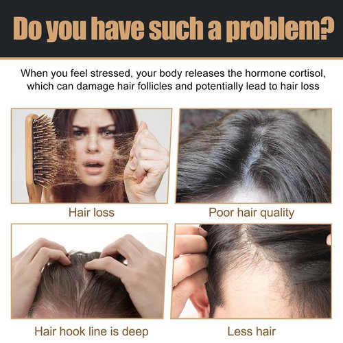 2 PCS Root Activator Shampoo, Hair Growth Root Activator Shampoo, Natural Formula for Men and Women, For Anti-Hair Loss