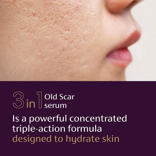 Mederma Scar Serum – Triple-Action Formula with Vitamin E, Hyaluronic Acid & Niacinamide – Clinically Shown to Reduce Old Scars, 1 Fl. Oz.