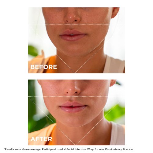 Clarins V-Facial Intensive Wrap Face Mask - Award-Winning Contouring Mask | Reduces Puffiness & Swelling | 2.5 Oz