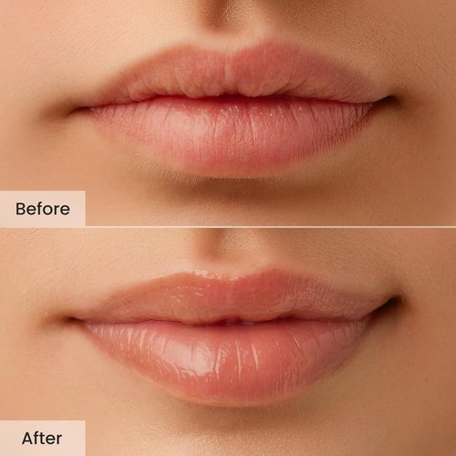 CNP Honey Lip Butter - Hydrating Overnight Manuka Lip Balm & Mask | 12hr Moisture, 0.5 fl. oz.