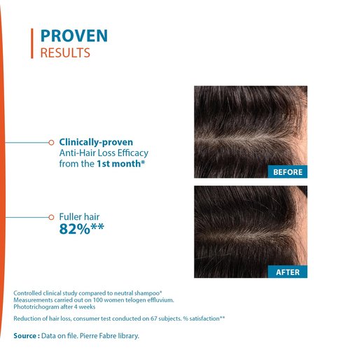 Ducray Creastim Hair Loss Lotion - 60 ml | Reactivating Formula for Thicker Hair