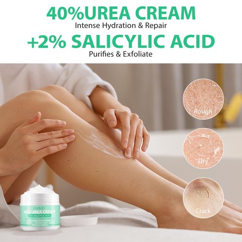 Jiugonggang 40% Urea Cream with 2% Salicylic Acid for Dry Cracked, Feet/Heel Cream Moisturizer for Dry Cracked Heel, Knees, Elbows, Hands, Callus Remover, Callus Remover,Feet Repair Cream, 5.3 Oz