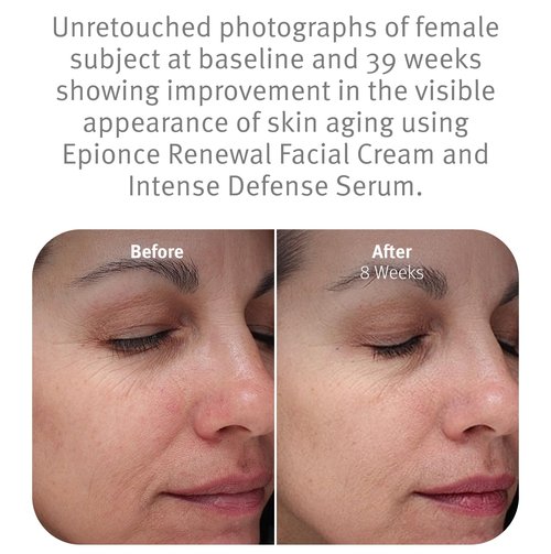 Epionce Renewal Facial Cream - Hydrating Anti-Aging Moisturizer for Dry & Sensitive Skin | Reduces Fine Lines