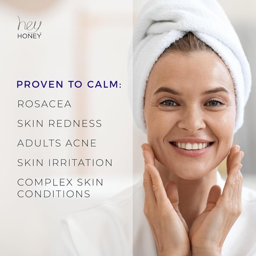 Hey Honey Skincare Instant Rosacea Relief Cream - Calming Moisturizer for Sensitive Skin | Oil-Free with Honey & Propolis | 2.2 Oz