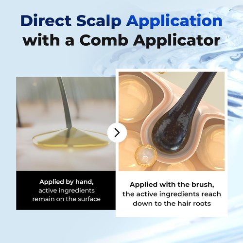 EPAIS Scalp Boosting Serum - 150ml Comb Applicator with 38 Brush Tips for Dandruff Reduction | Korean Hair Care