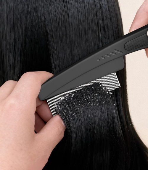 Dandruff Comb | 2PC Upgraded Fine Tooth Scalp Detox Tool for Women, Men & Kids - Purple Hair Care Set