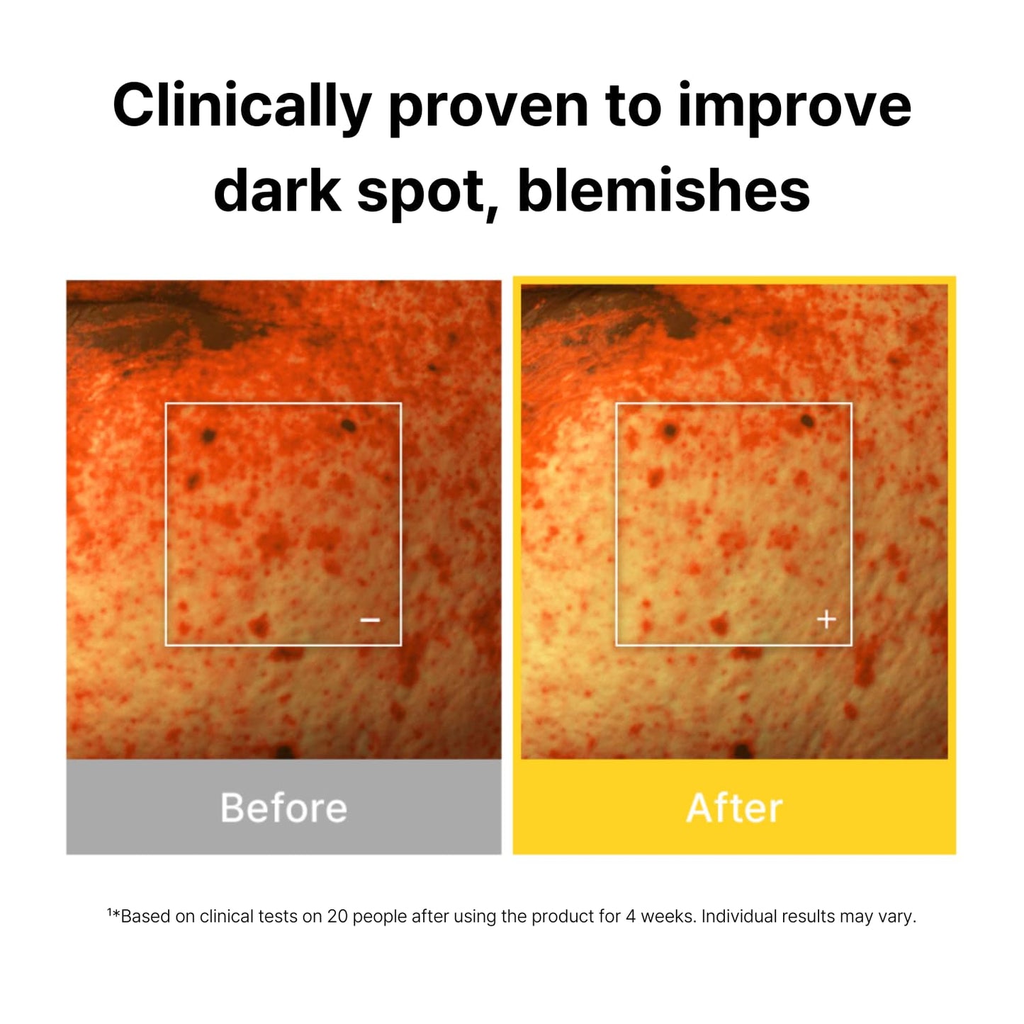 Cell Fusion C Toning C Serum - Dark Spot Treatment with Vitamin C & Niacinamide | 1.01 fl. oz for Radiant Skin