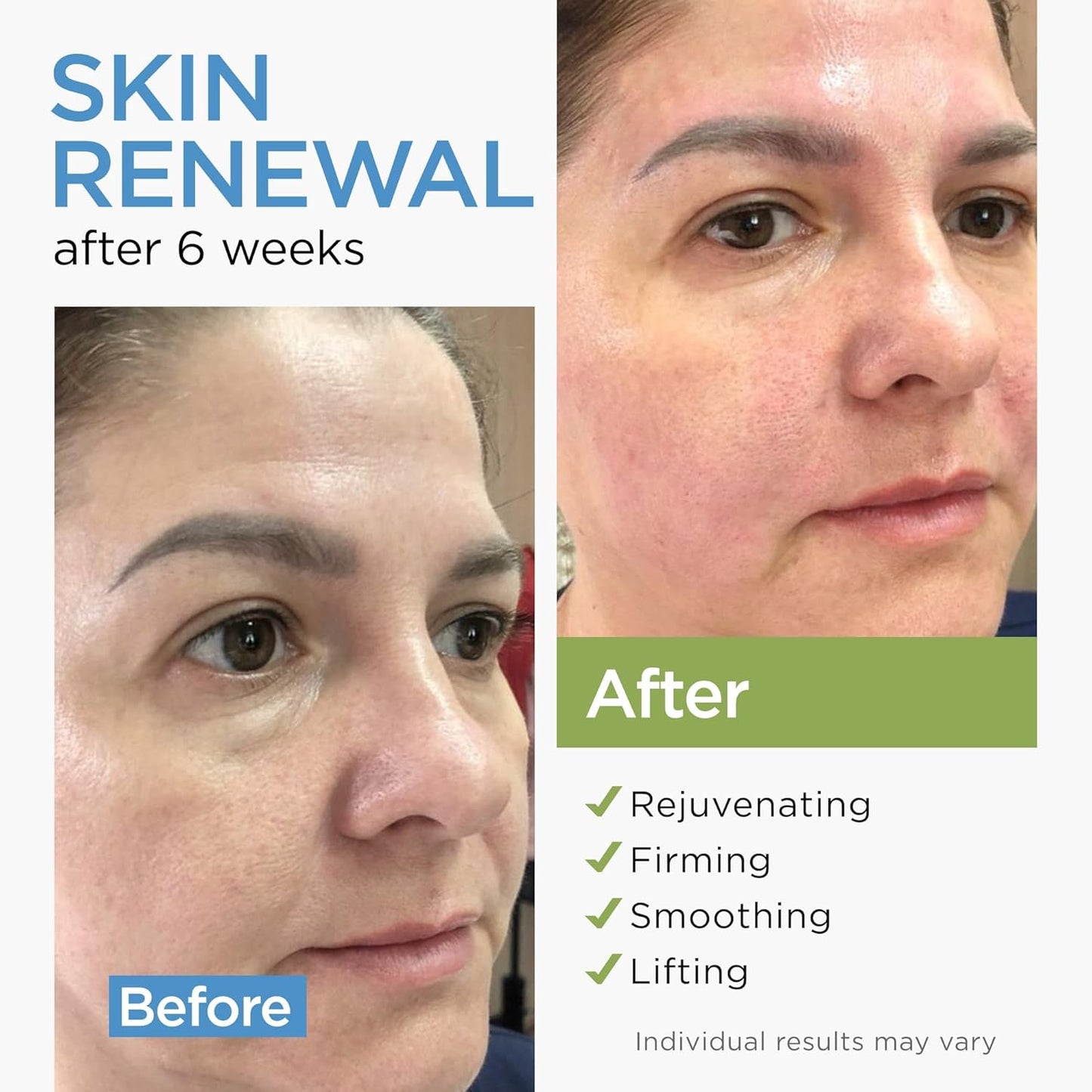 Skiennix Collagen Face Cream - Anti-Aging Moisturizer with Retinol & Hyaluronic Acid | 1.7 Oz, All Skin Types