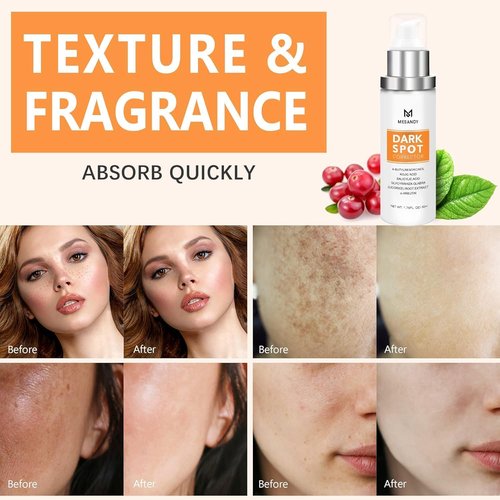 Regine Switzerland Dark Spot Remover - 5% Niacinamide Anti-Aging Fade Cream for All Skin Types