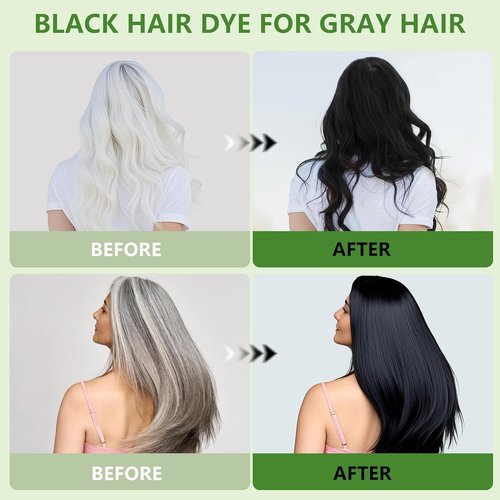 Regine Switzerland Black Hair Dye Gel - 3-in-1 Gentle Formula for Men & Women | Complete Gray Coverage, 200ml