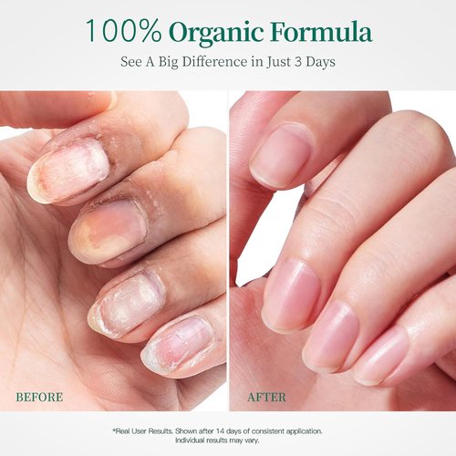 Apuree 100% Bio-Based Cuticle Oil - Deep Moisture Nail Strengthener with Black Rose Extract | 1oz Vegan Formula for Dry Cuticles and Brittle Nails