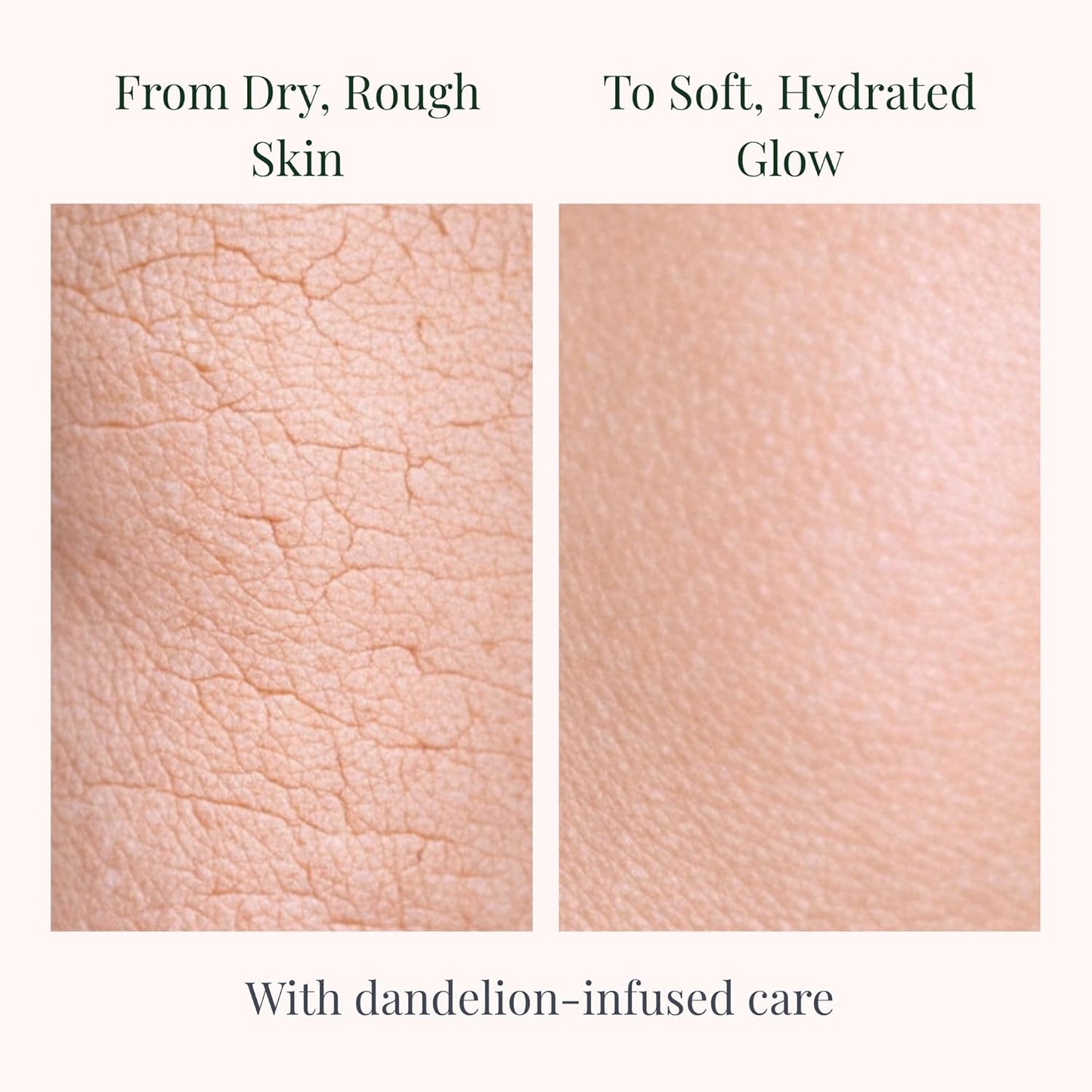 Skiennix Body Lotion - Deep Hydrating Botanical Moisturizer with Dandelion Oil | 8 oz for Dry & Sensitive Skin