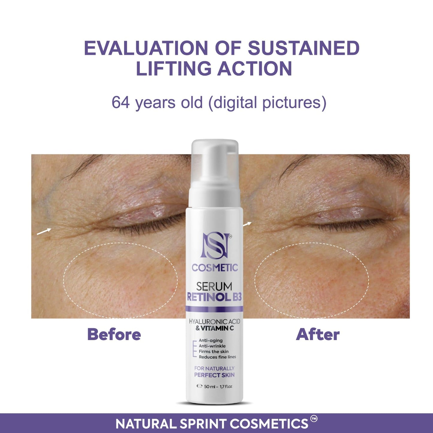 Skiennix Anti-Aging Face Serum - Retinol, Vitamin C & Hyaluronic Acid for Deep Hydration | 50 ml