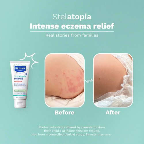 Mustela Eczema Relief Cream - Fragrance-Free Moisturizing Lotion with Colloidal Oatmeal | 5.07 fl. oz. for Dry, Itchy Skin