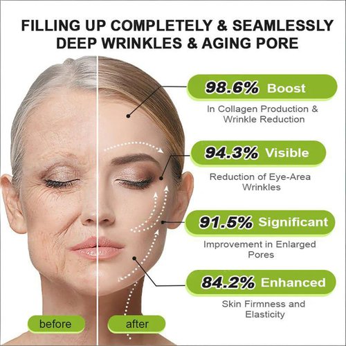 Botoxmix & Vita-A Retinol Shot Wrinkle-Lift Tightening Cream, Wrinkle-Lift Tightening Cream, effectively lifts and firms the skin, and reduces wrinkles and fine lines. (1PC)