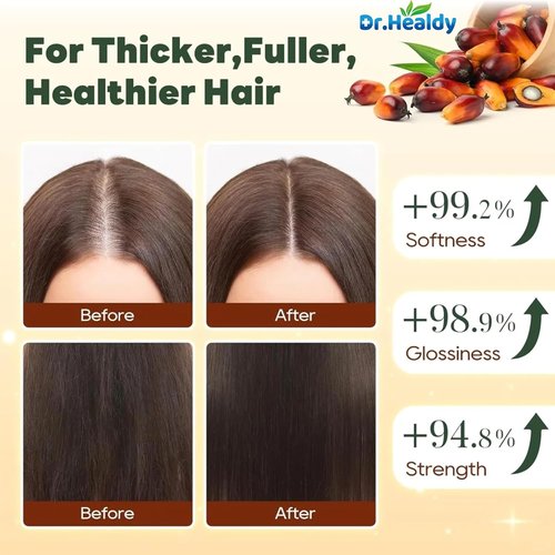 Batana Oil Shampoo and Conditioner Set - for Hair Growth,Thickening & Hydration,Sulfate Free - Fights Hair Loss & Clarifies Scalp - for Men & Women (6.8 Fl Oz×2)