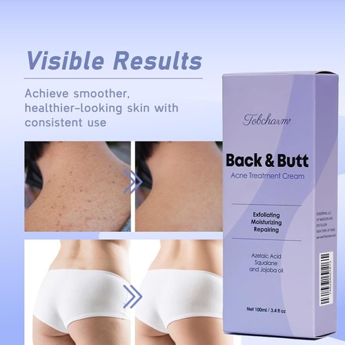 Regine Switzerland Butt Acne Clearing Treatment - Maximum Strength Body Cream for Back & Thighs | Foaming Cleanser for Men & Women