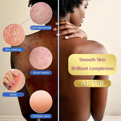 African Net Sponge | 4-Piece Exfoliating Shower Loofah Set for Gentle Cleansing & Daily Use