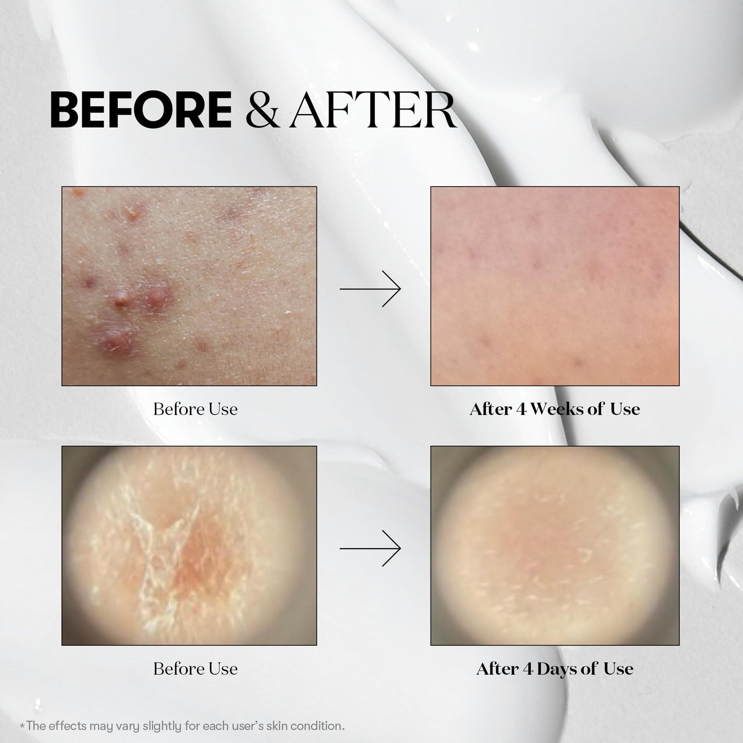 VT COSMETICS CICA Reedle Shot 50, Spicule Microneedling Serum for Pore Care & Exfoliation, Exosome, Centella Asiatica for Glass Skin, Smooth Texture, Korean Liquid Skin Booster (1.69 Fl Oz / 50ml)