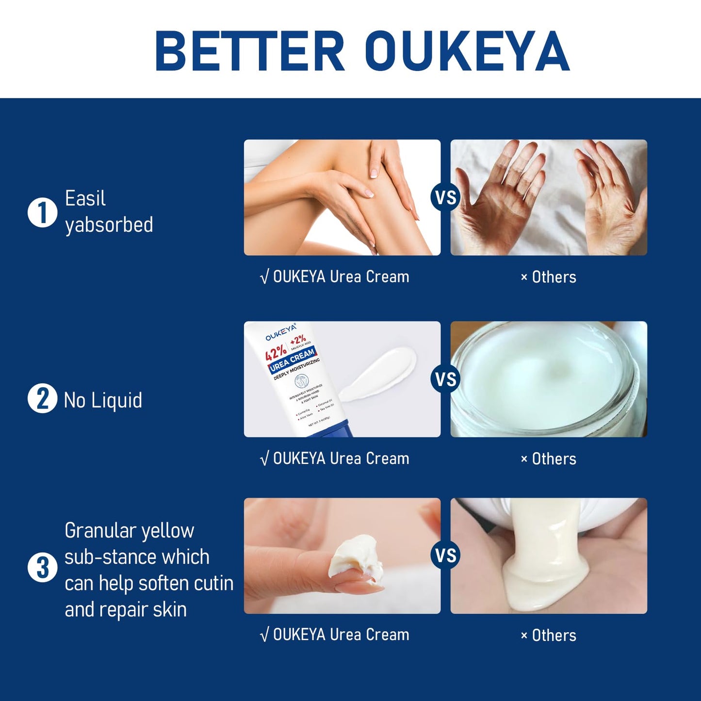 OUKEYA Urea Cream 42 Percent with 2% Salicylic Acid Tube 3 Oz, Urea Foot & Hand Cream for Dry Cracked, 40 per Urea Lotion for Feet Maximum Strength
