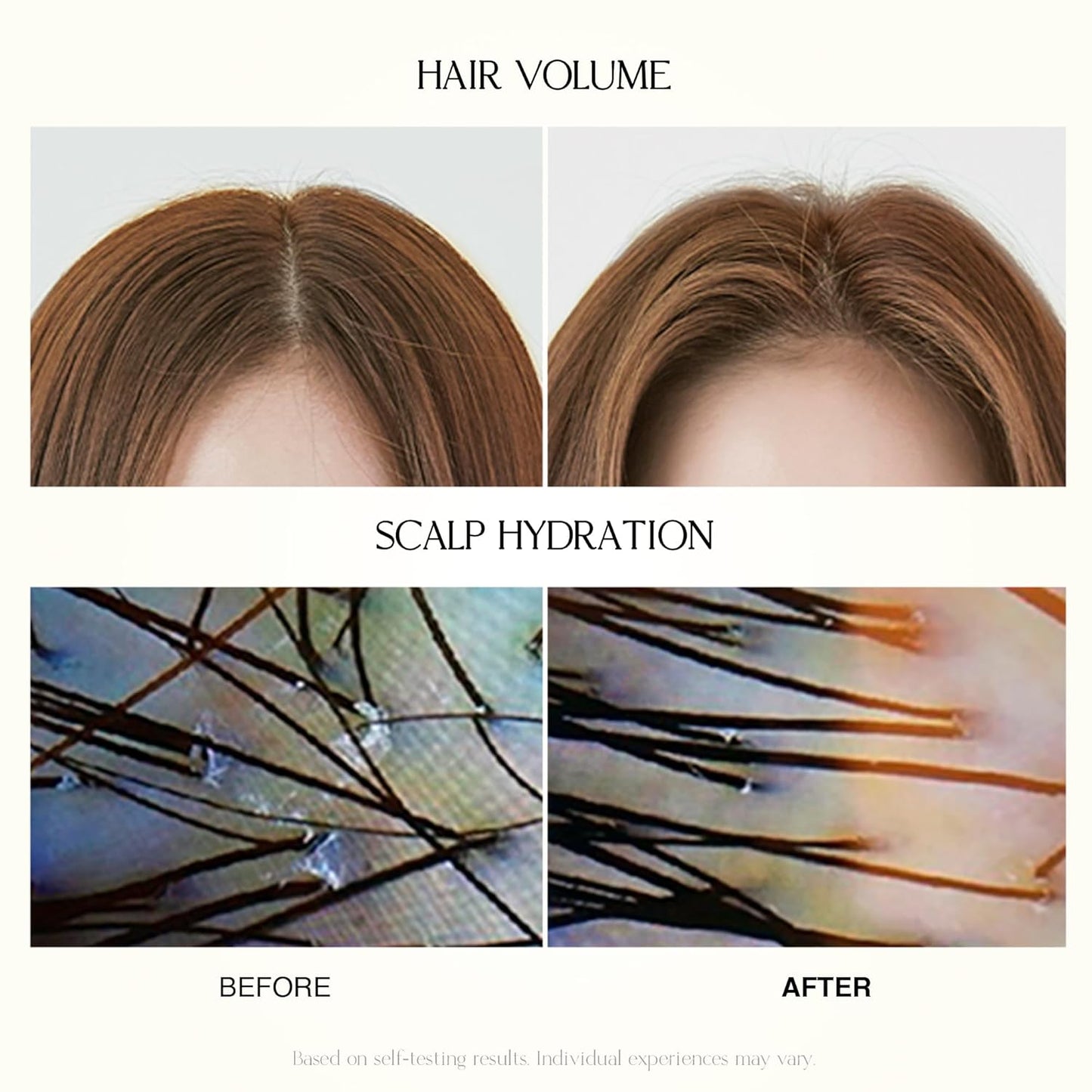 Skiennix Mild Moisture Shampoo - Hydrating & Nourishing for Normal to Dry Scalp | 16.9 fl oz