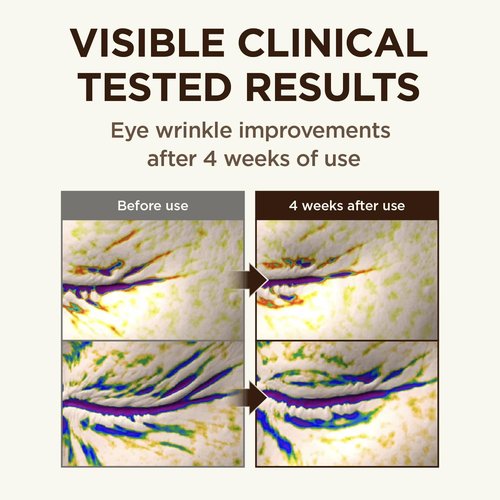 CKD Retinal 5X Gua Sha Eye Cream - Anti-Aging Moisturizer for Dark Circles & Puffiness | Firming & Hydrating Treatment, 1.01 fl oz