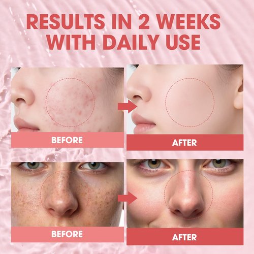 PDRN Pink Glow Serum with Peptides & Niacinamide – Hydrating Korean Glass Skin Serum for Firming, Brightening & Smoothing – 1.01 fl. Oz