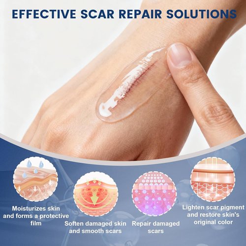 100% Silicone Scar Gel Scar Cream, Advanced Silicone Gel for Removal of Surgical, Burns, Acne Scar, Old and Recent Scars and Stretch Marks, 1.7 oz/50ml