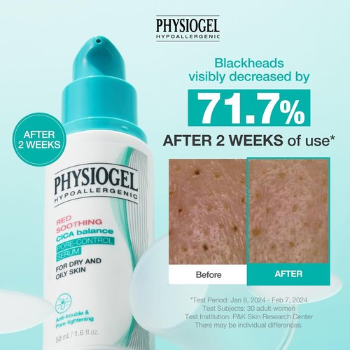 Physiogel Red Soothing CICA Balance Serum - Niacinamide Pore-Control Exfoliant for Blackheads | 1.69 fl. oz