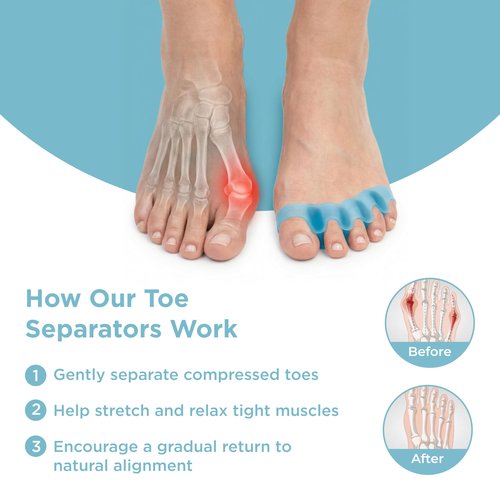 Mind Bodhi Toe Separators/Toe Spacers - For Men and Women - Large Size – Black