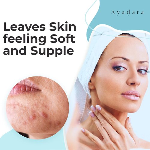 Ayadara Acne Facial Moisturizer - Advanced Oil Control Cream for Oily Skin | 2 Fl Oz Hydrating Formula