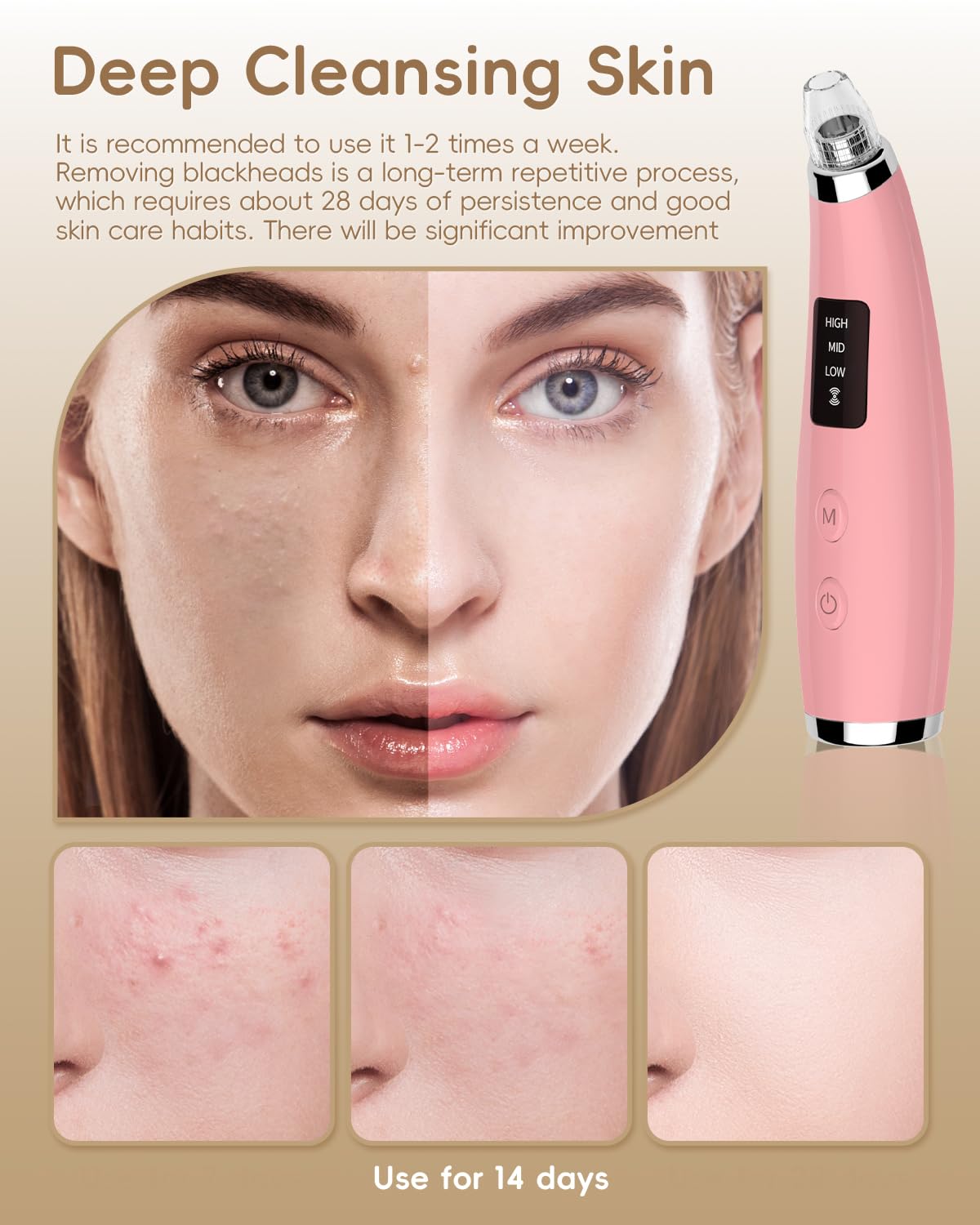 Facial Pore Blackhead Remover Vacuum - Face Cleaner and Blackhead Extractor with 3 Adjustable Suction Levels, 5 Probes, USB Charging Interface - Pore Vacuum Kit for Women&Men (Pink)