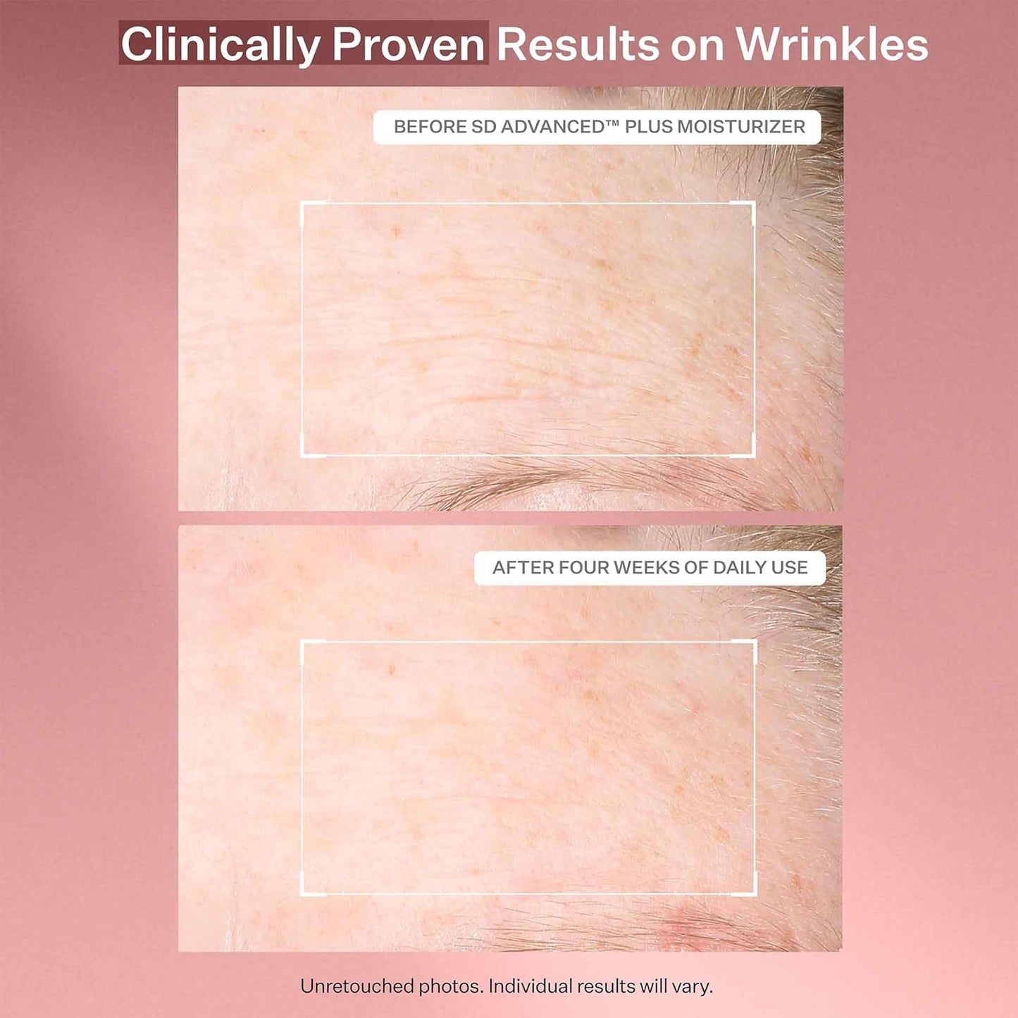 StriVectin Anti-Wrinkle Face Cream - Ceramides & Peptides for Firm Skin | Reduces Fine Lines & Crow's Feet