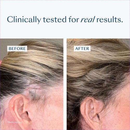 eSalon Densifying Scalp Serum - Procapil & Redensyl Formula for Thicker Hair | 1 Fl Oz