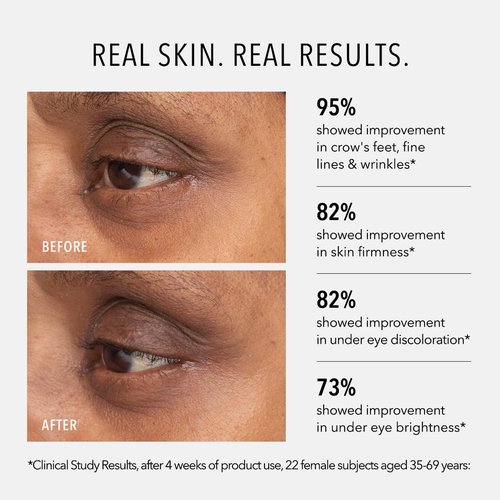 HydroPeptide Retinol Eye Renewal Balm - Lifting & Firming with Tri-Retinol Complex | 0.5 Ounce