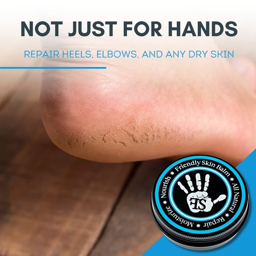 Organic Friendly Skin Balm - Organic Rock Climbing and CrossFit Hand Care for Athletes - Skin Friendly Moisturizing and Repair for Hands, Feet, Elbows and Lips