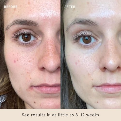 Barefaced Hydrating Lotion - Oil-Free Lightweight Face Moisturizer with Niacinamide & Hyaluronic Acid | 1.7 Fl Oz for Soft, Balanced Skin