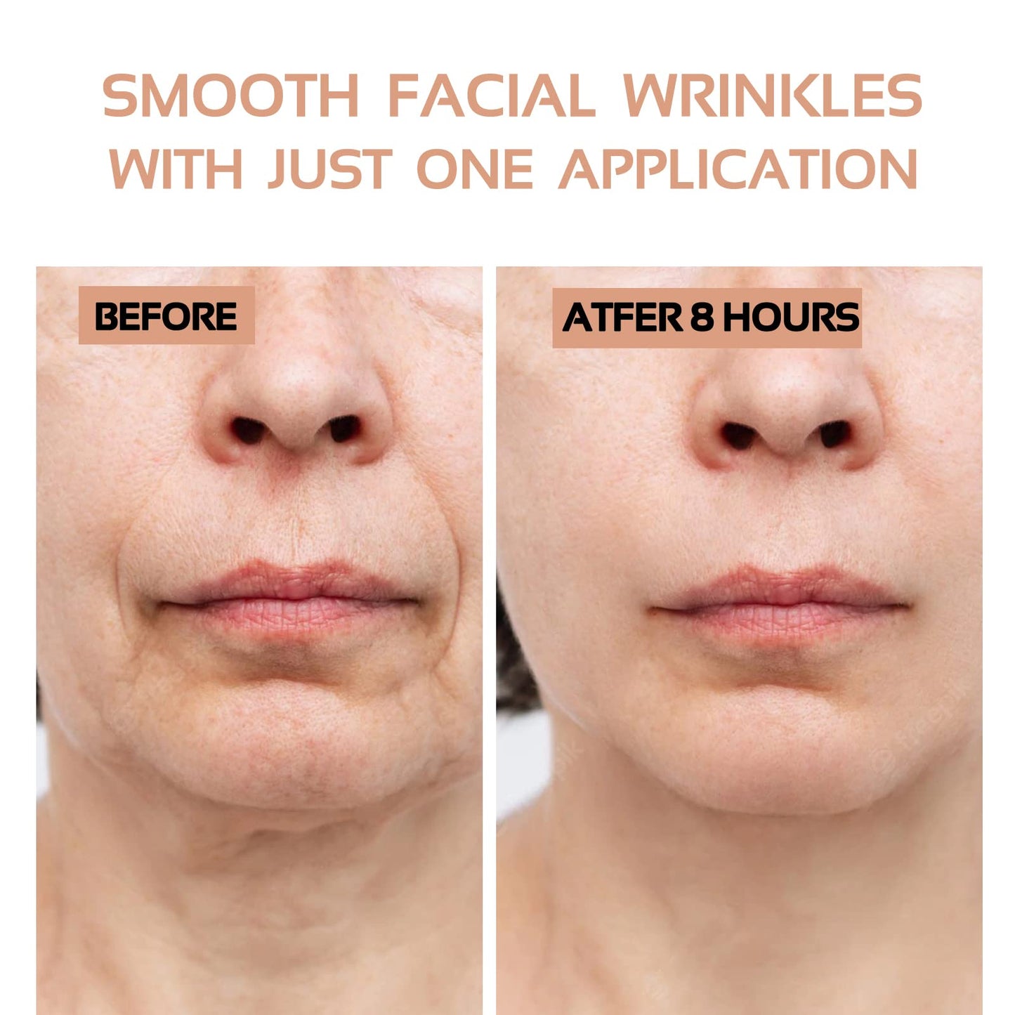 ENROSLU Face Wrinkle Patches 256Pcs - Clear Reusable Pads for Overnight Anti-Wrinkle Treatment - Fine Line Remover Strips to Smooth Eye, Mouth and Forehead - Train Facial Muscles for Smoother Skin