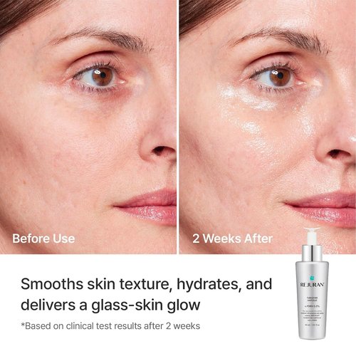 REJURAN® Turnover Ampoule - c-PDRN® Salmon DNA Face Serum for Rejuvenation & Hydration | 1.01 fl oz