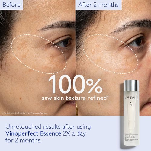 Caudalie Vinoperfect Brightening Essence - Glycolic Acid Exfoliating Toner for Radiant Skin