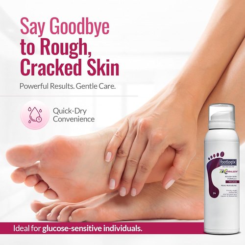 Footlogix Rough Skin Formula - Mousse for Dry, Cracked Heels & Feet Treatment | 4.23oz