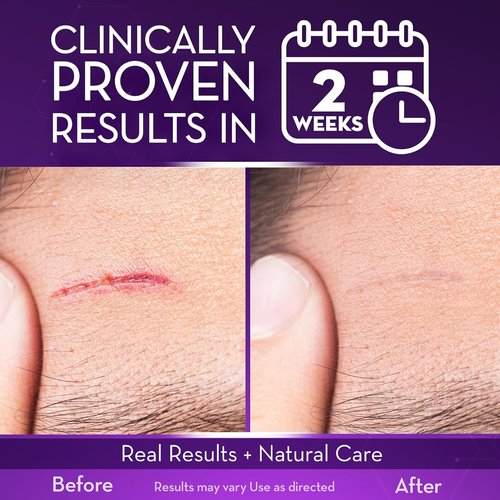 Cicatricure Advanced Scar Gel for Face & Body - Proven Results in 2 Weeks, Scar Treatment for Surgical Scars, Stretch Marks, Scars of Burns and Injuries, Acne Scar Treatment, 1 oz (28 g)