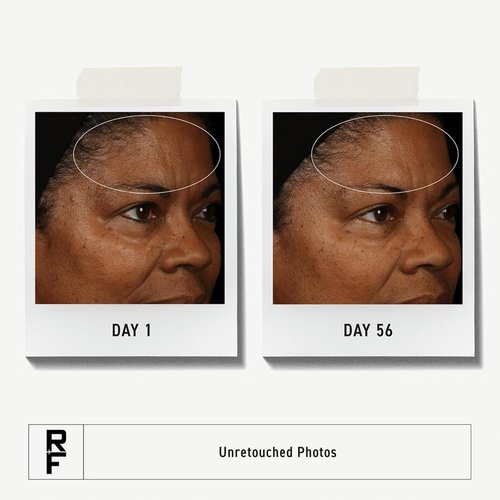 Rodan + Fields Redefine Daily Face Clay Cleanser - Exfoliating Anti-Aging Wash for Sensitive Skin (125 mL)