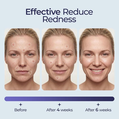 ECOLOOK Disposable Face Towels - XL 60 Count Ultra Soft & Thick 10"x12" for Sensitive Skin