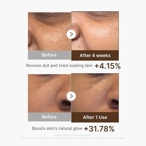 Medicube Deep Vitamin C Capsule Serum - Hydrating Serum for Dull Skin | Liposome Capsules for Radiant Texture | 1.01 fl. oz