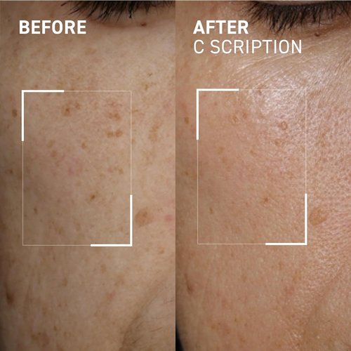 Dr. Brandt Bright This Way C Scription - Vitamin C Serum for Dark Spots & Wrinkles - 1 Fl Oz