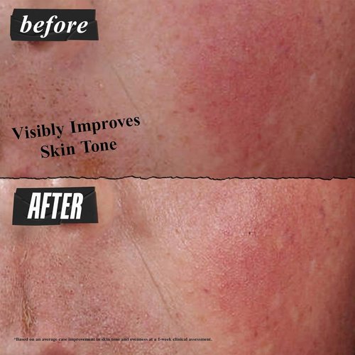 Kiehl's Ultra Facial Advanced Repair Cream - Intensive Treatment for Dry & Sensitive Skin, Fast-Absorbing, 1.7 fl oz