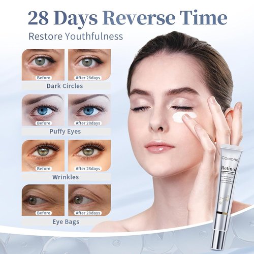 Regine Switzerland Retinol Under Eye Cream - Anti-Aging Treatment for Dark Circles & Puffiness | Gentle Formula for All, 0.7 Fl Oz